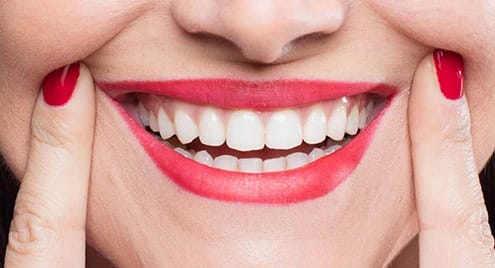 botox-for-gingival-smile2 botox-for-gingival-smile2