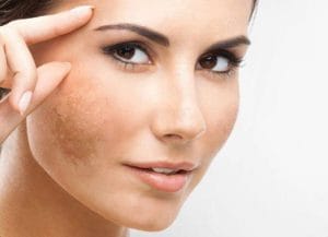 تعداد جلسات مزوتراپی لک صورت