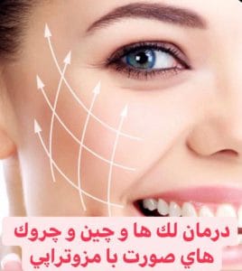 مزوتراپی برای درمان لک صورت