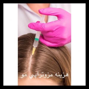 هزینه مزوتراپی برای ریزش مو