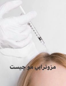 مزوتراپی مو چیست