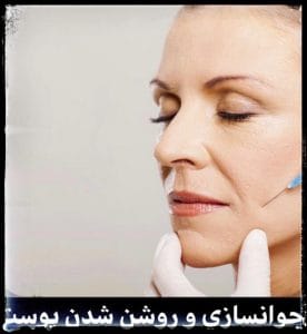 مزوتراپی وشن کننده پوست