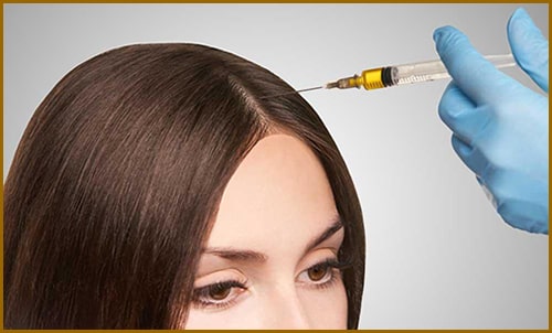 درمان ریزش مو با مزوتراپی